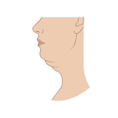 Moderada